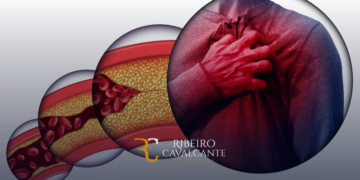 Cardiopatia grave: Auxílio-doença e aposentadoria por invalidez 2025